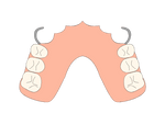 Acrylic Partial Denture