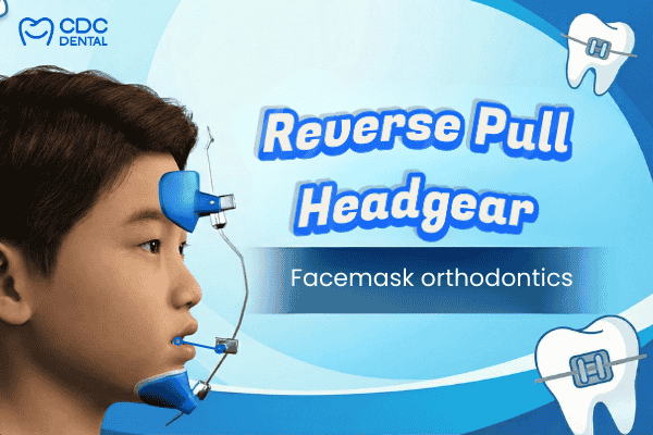 Orthodontic Facemask for kids for correcting an underbite
