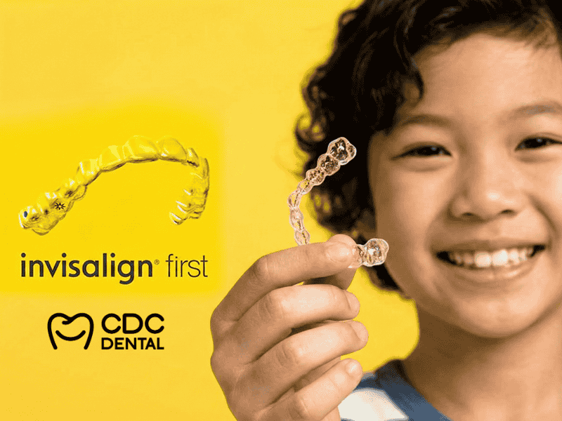 Invisalign for kids bangkok