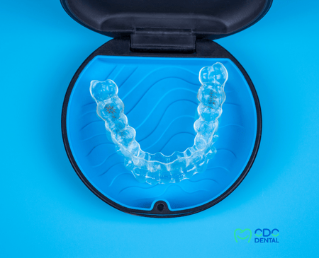 What is Clear Aligner