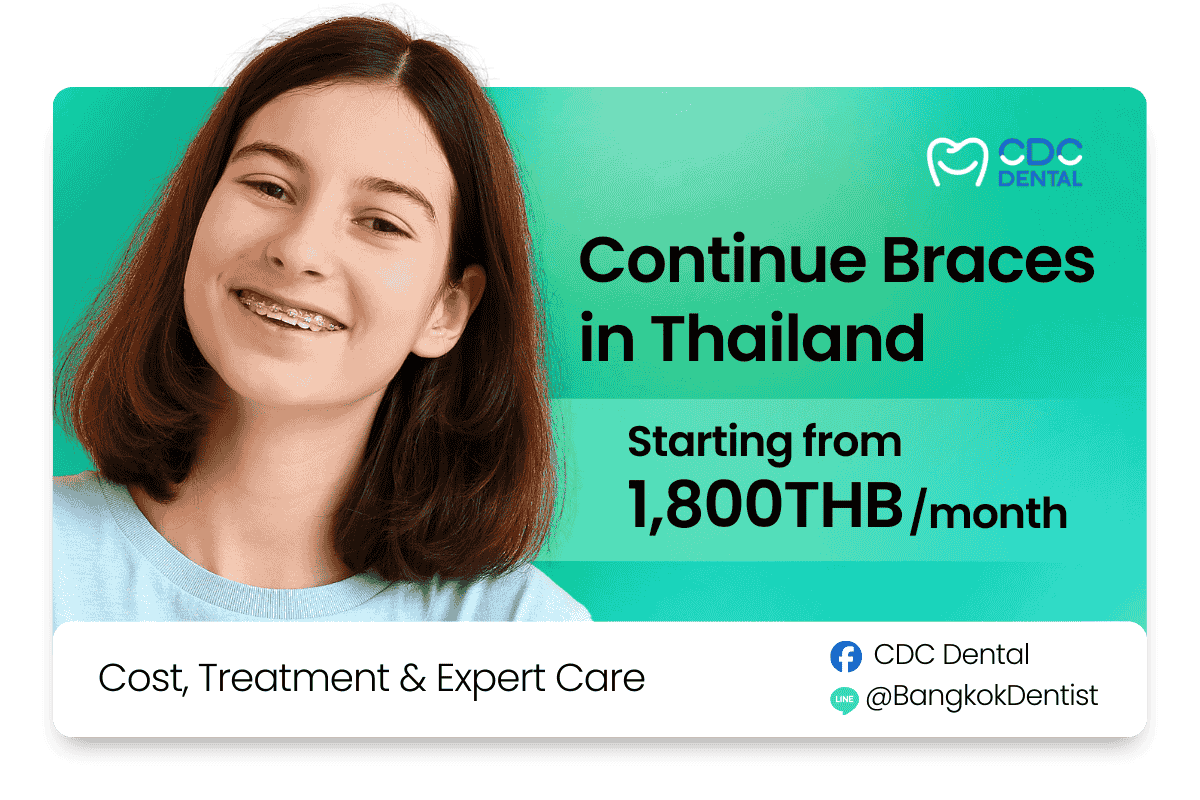 continue braces in thailand