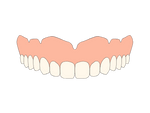 Complete Denture
