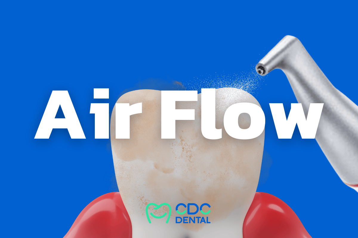 Airflow