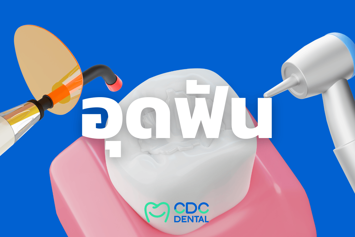 Dental Fillings