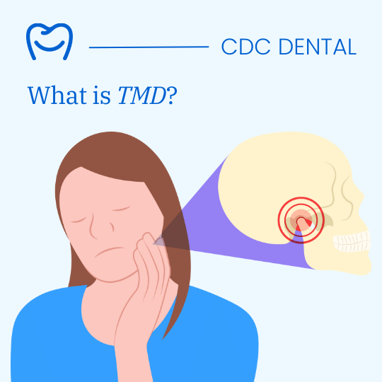 TMJ Pain Illustration