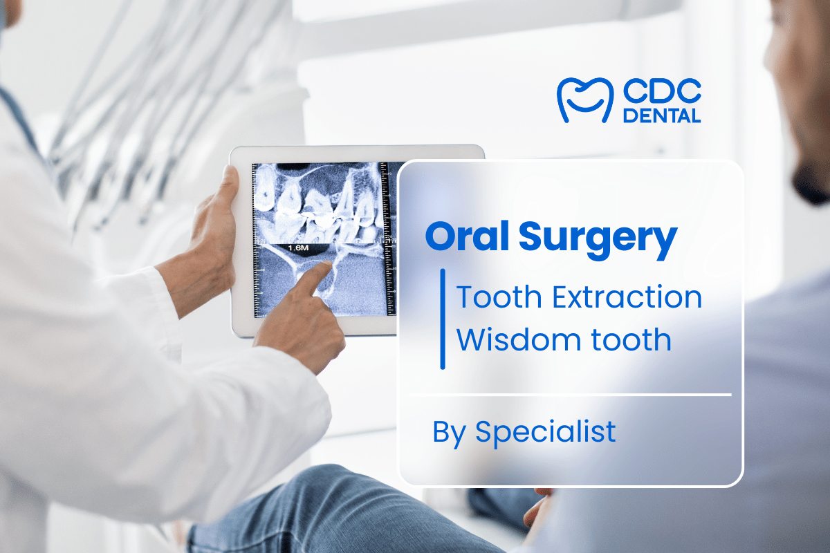 Tooth Extraction Price