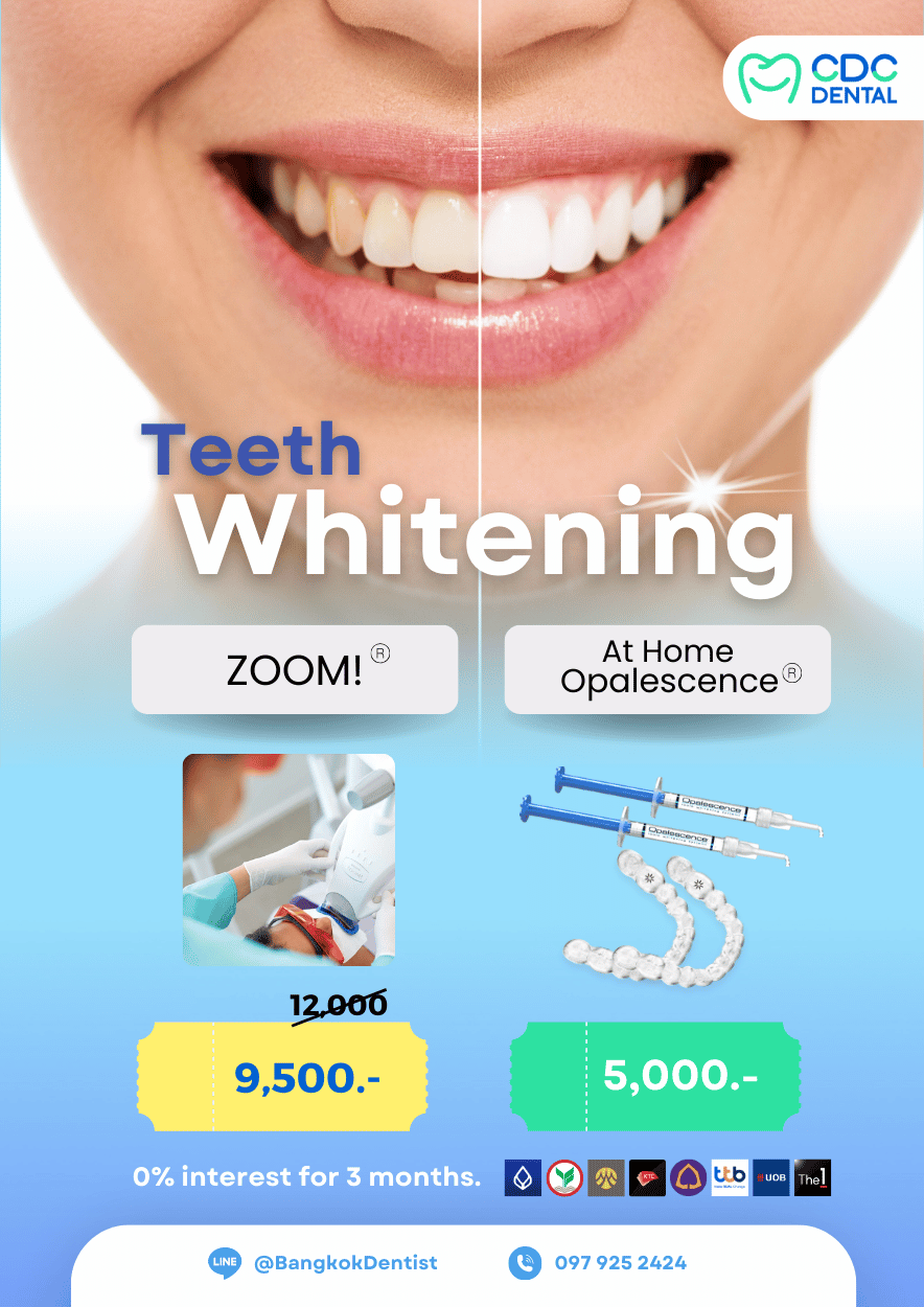 teeth whitening bangkok price