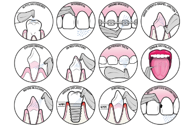 บริการขูดหินปูน Airflow ขจัดคราบชากาแฟ