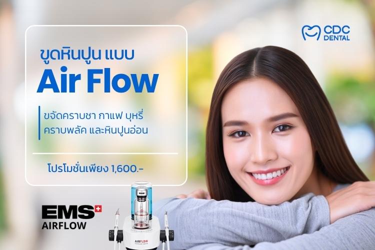 ขูดหินปูน Air flow