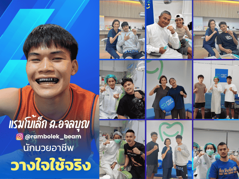 ทำฟันยางนักมวย ที่ไหนดี