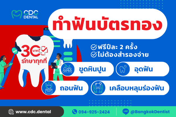 ทำฟันบัตรทอง สะพานควาย