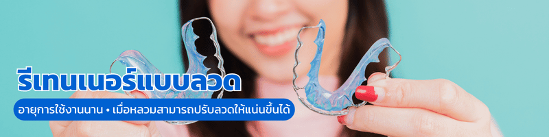ราคาแบบลวด