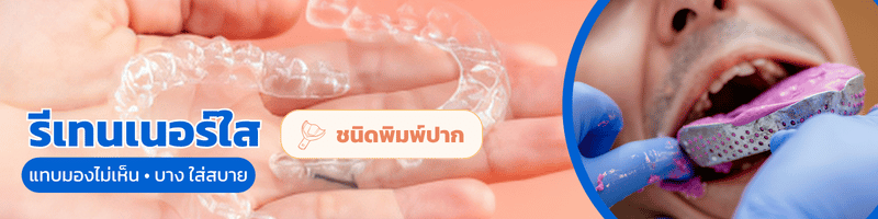 ราคาแบบใส
