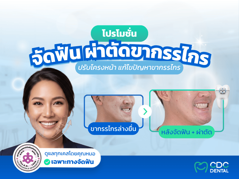 จัดฟันร่วมกับการผ่าตัดขากรรไกร CDC Dental สะพานควาย และลาดพร้าว 109