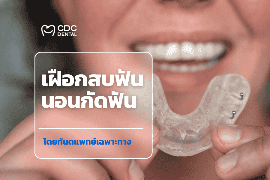 นอนกัดฟัน เฝือกสบฟัน