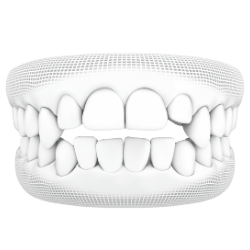 จัดฟันใสเคสซับซ้อน