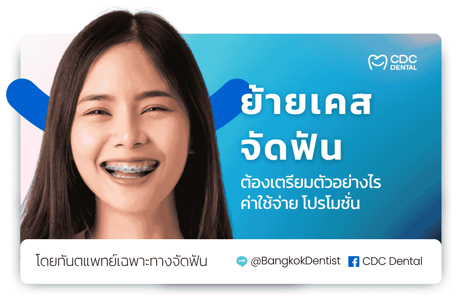 ย้ายเคสจัดฟัน ใกล้ฉัน