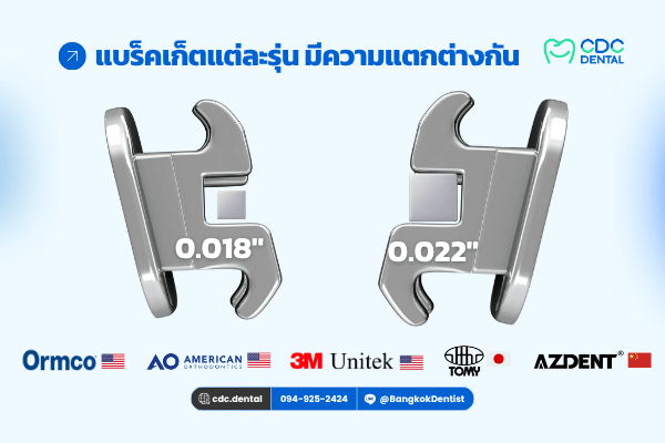 ย้ายเคสจัดฟัน ใช้เครื่องมือเดิมได้ไหม