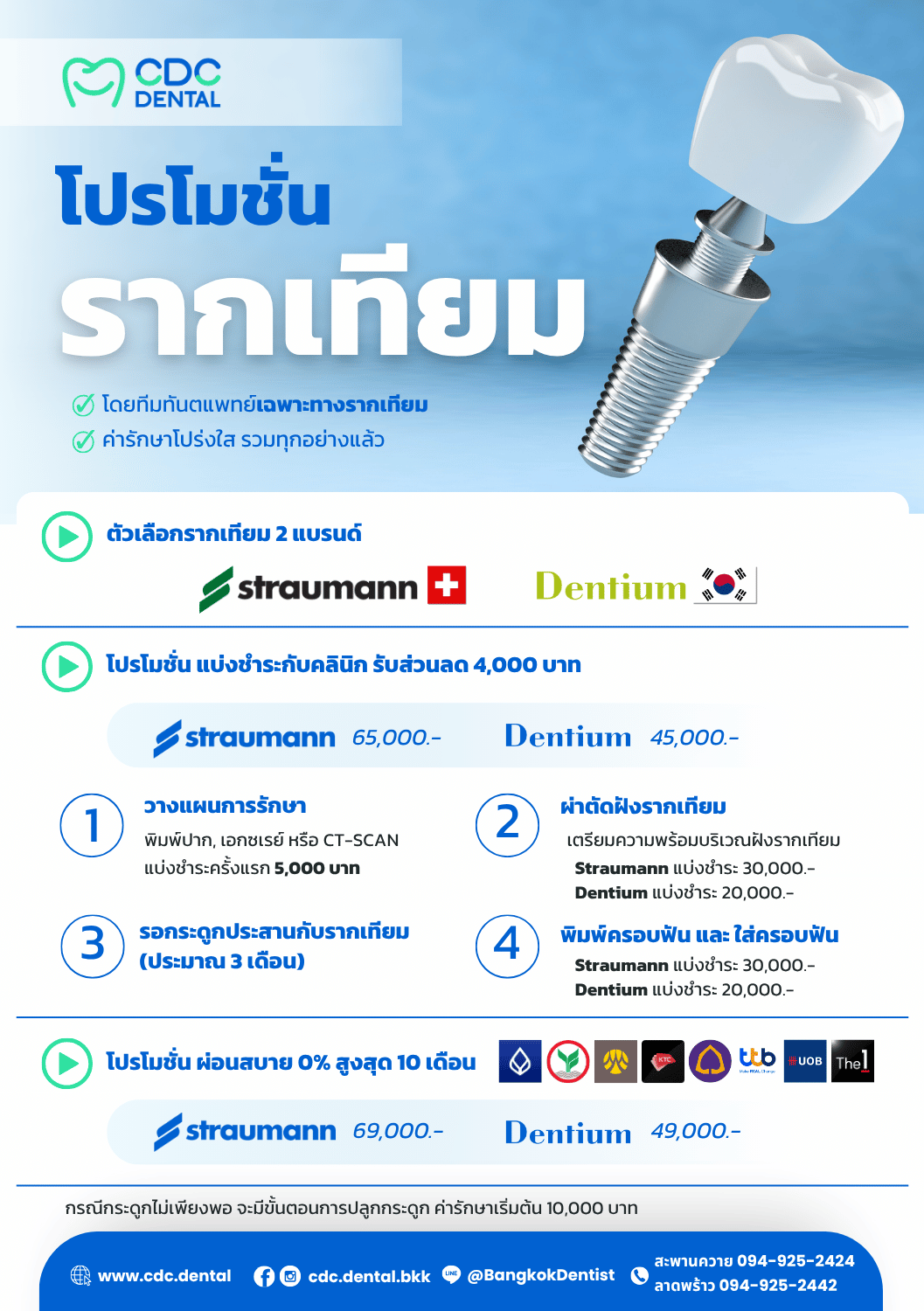 รากเทียม ราคา