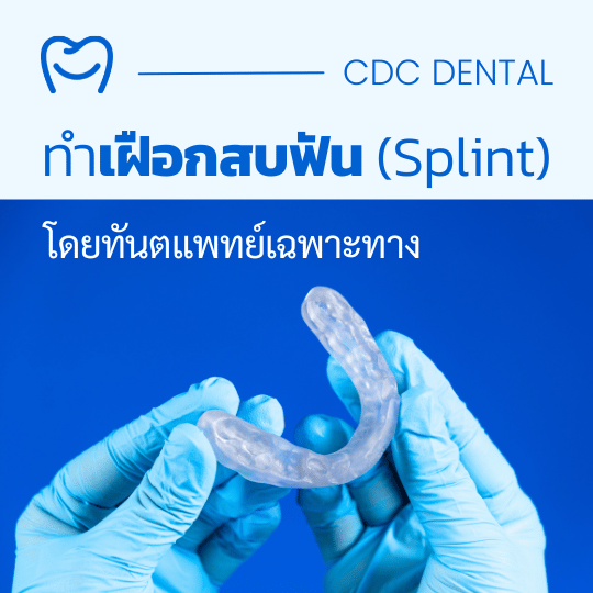 เฝือกสบฟัน
