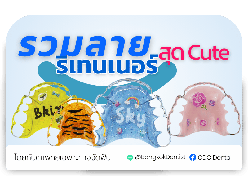รวมลายรีเทนเนอร์น่ารักๆ