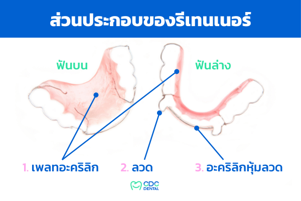 รีเทนเนอร์แบบลวด (รีเทนเนอร์โลหะ)