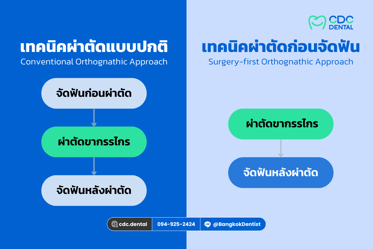 ผ่าตัดก่อนจัดฟัน