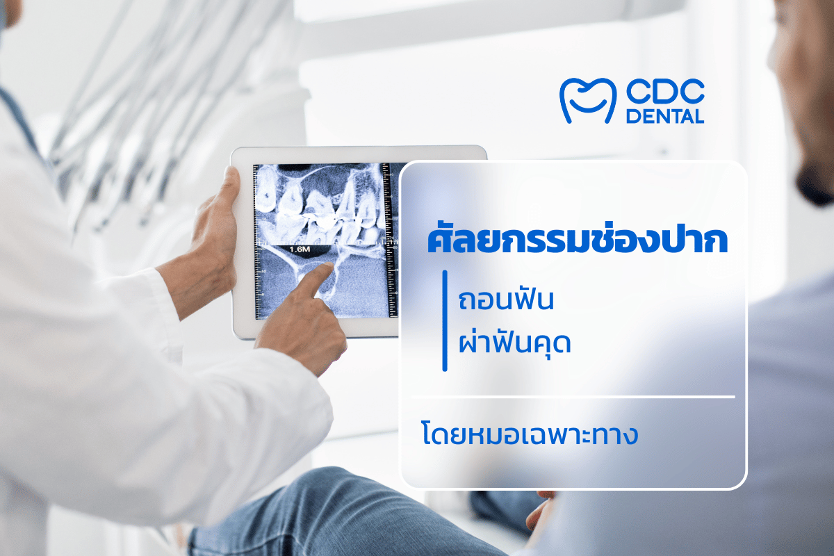 ถอนฟัน ราคา