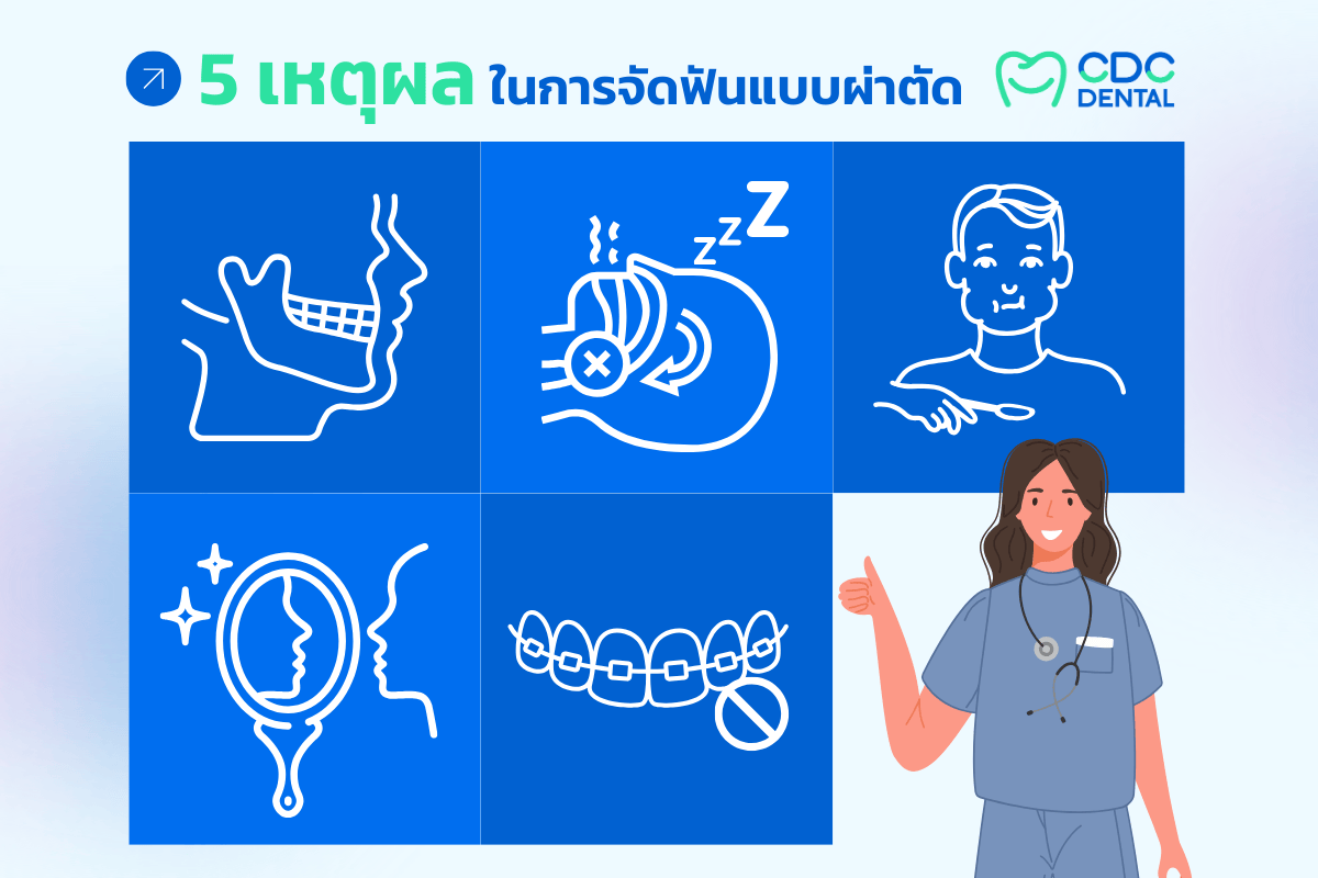 ทำไมต้องจัดฟันผ่าตัด