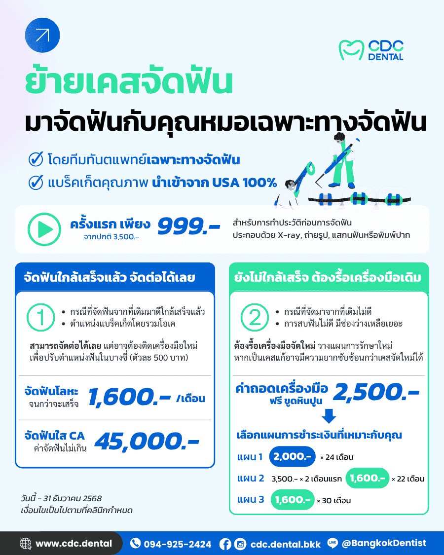 ย้ายเคสจัดฟัน ราคา
