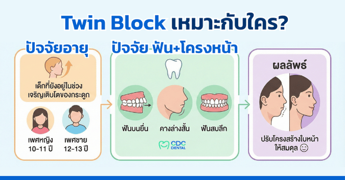 ข้อบ่งชี้ twin block
